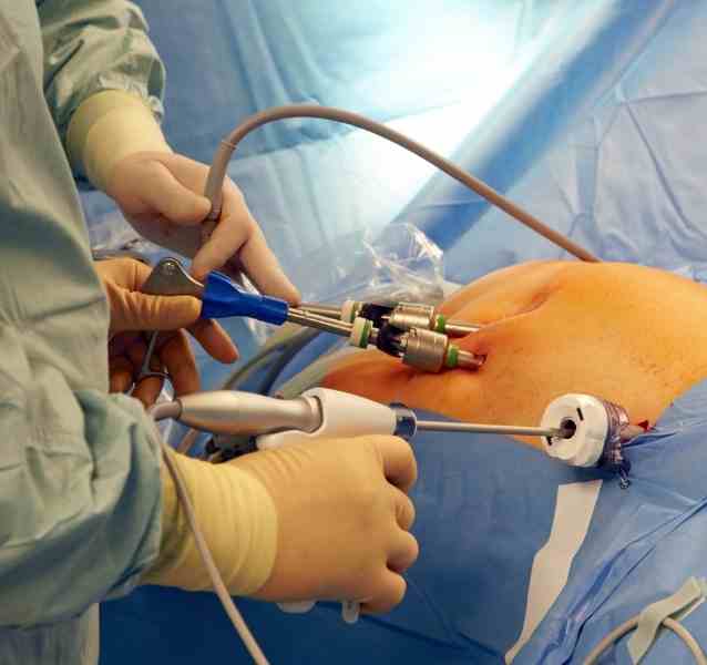 gynecological cancer | Laparoscopy training | laparoscopy surgeon in ahmednagar
